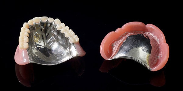 金属床義歯（自費適用）